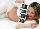 Възможно ли е да забременеете по време на кърмене?