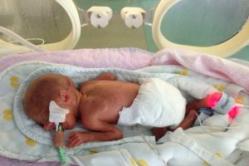 Bayi baru lahir prematur: cara merawat bayi prematur Tanda-tanda fungsional bayi prematur